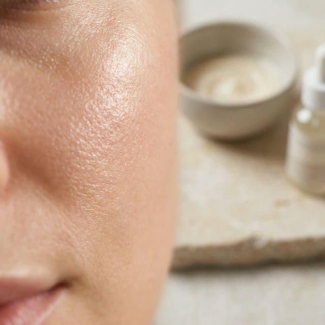 Consulta dermatologica personalizada